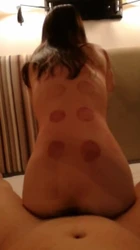 少妇拔火罐去火明细还不够, 需要肉棒进一步降火