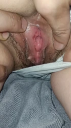 剖腹产少妇洞洞小小有认证